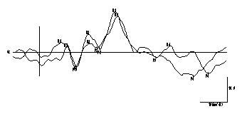 グラフ7　NS1のカタカナ刺激（視覚・聴覚）