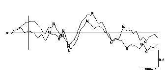 グラフ8　NS3のカタカナ刺激（視覚・聴覚）